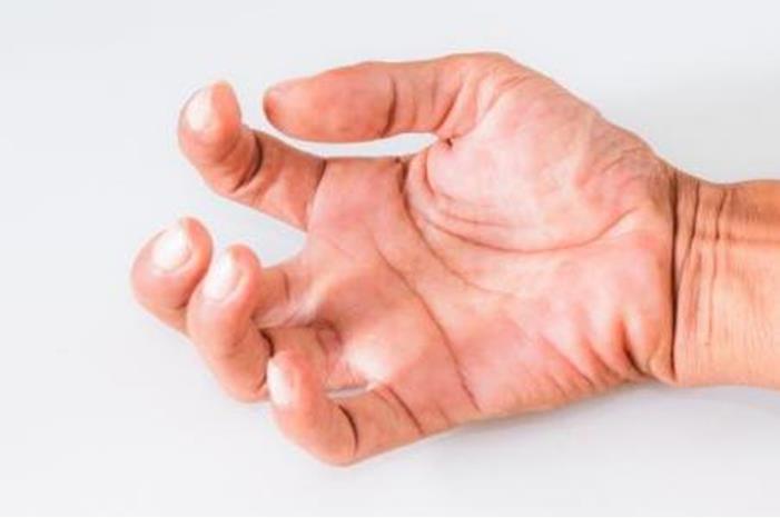 4 أسباب لتشنج أصابع اليد.