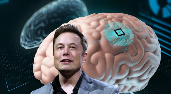 زراعة شريحة في دماغ الإنسان بقيادة إيلون ماسك