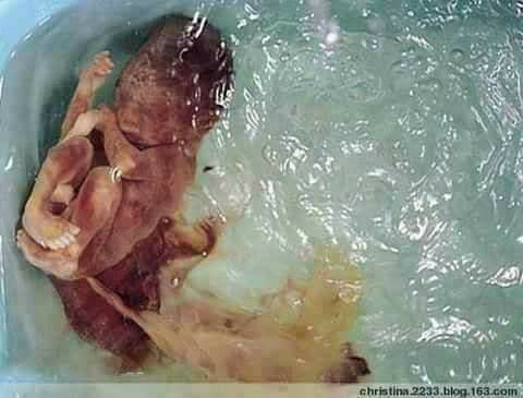 شوربة الأجنة المجهضة في الصين وصفة جديدة للصحة والجمال