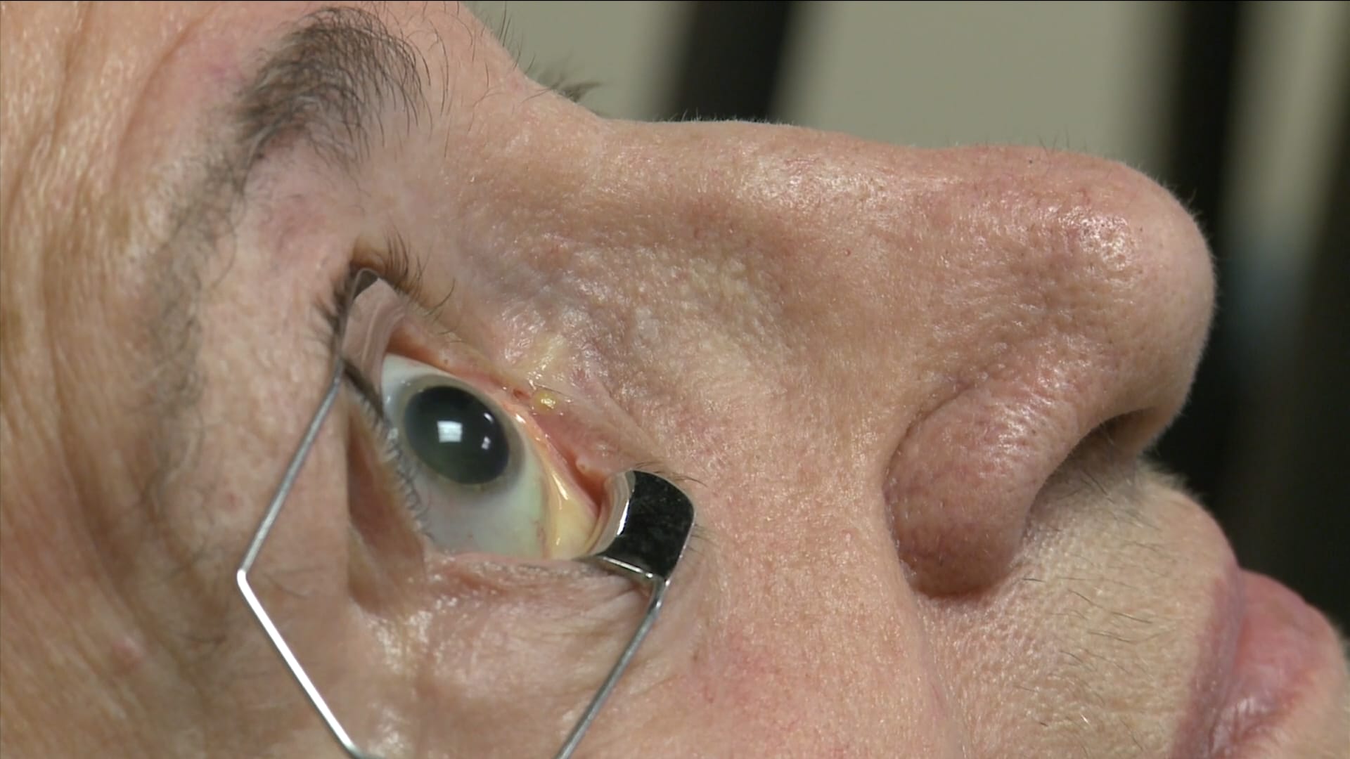 صورة حول : الميلاتونين يحمي المسنين من التنكس البقعي الميلاتونين يحمي المسنين من التنكس البقعي