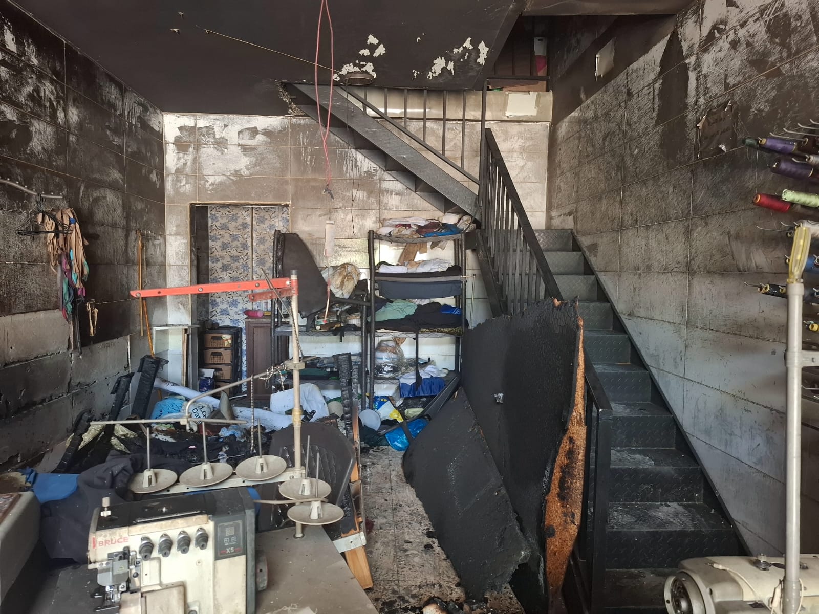 احتراق مخيطة C.F بالكرك احدى صديقات التليف الكيسي 