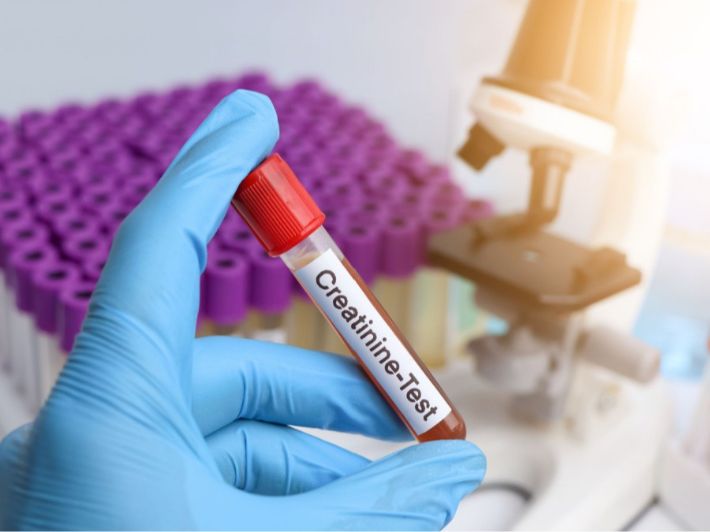 أعراض نقص الكرياتين وتأثيره على الأداء الرياضي