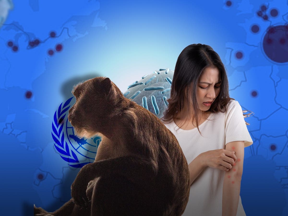 صورة حول : عاجل | مقارنة: جدري القرود وكورونا؟ أيهما أخطر عاجل | مقارنة: جدري القرود وكورونا؟ أيهما أخطر