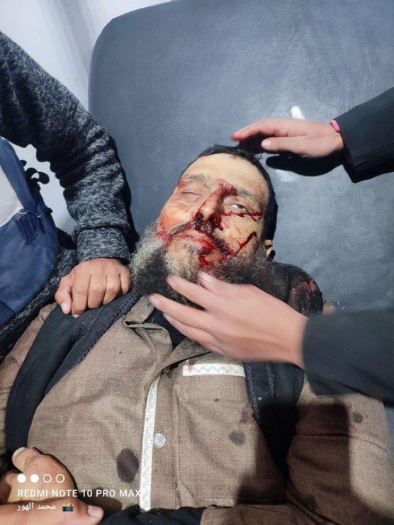 استشهاد صاحب مقوله "روح الروح " بقصف على مخيم النصيرات