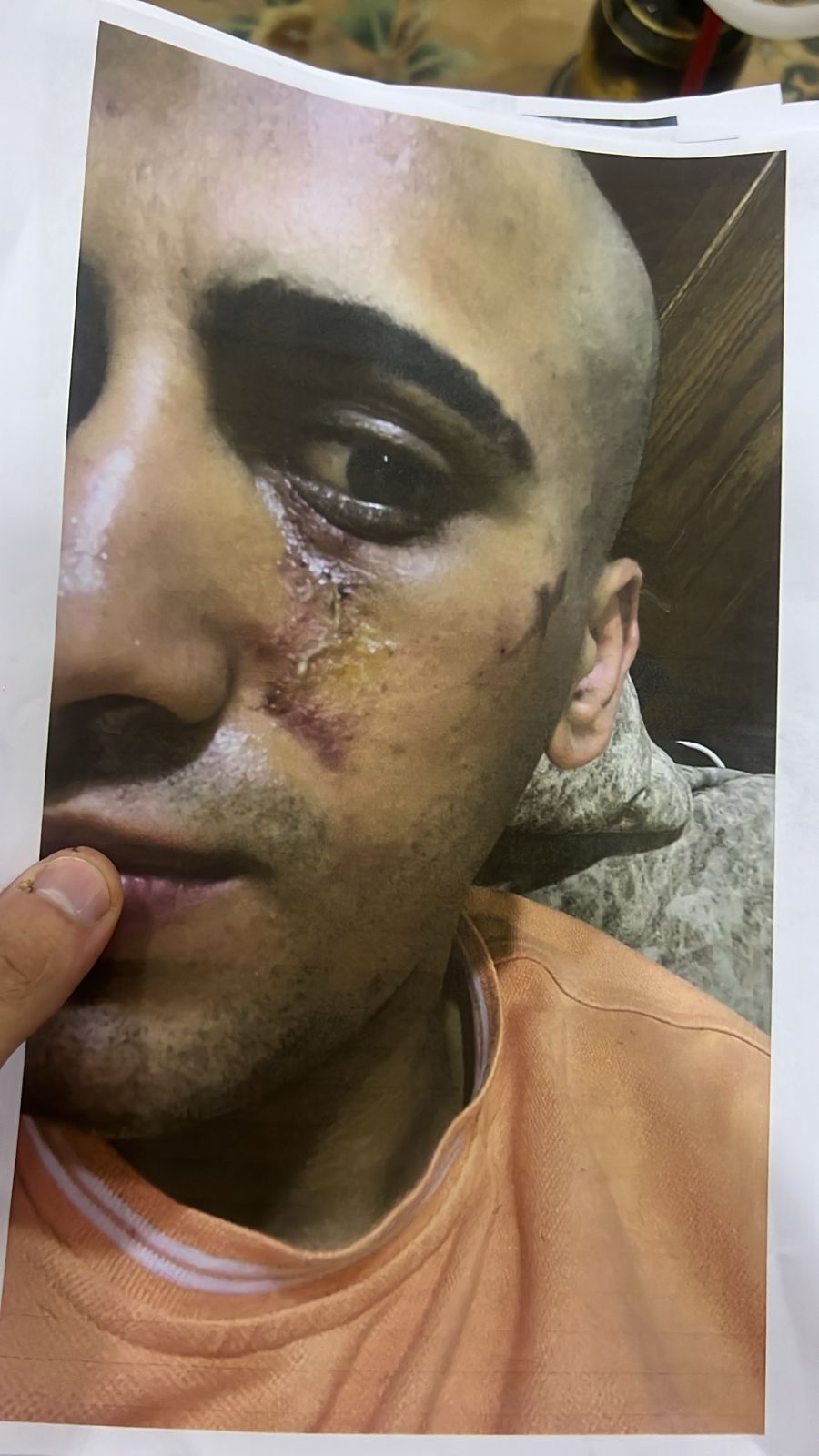 صورة حول : عاجل | أحمد يخرج عن صمته ويكشف تفاصيل تعذيبه هو وشقيقته على يد والده وإخوته .. فيديو وصور عاجل | أحمد يخرج عن صمته ويكشف تفاصيل تعذيبه هو وشقيقته على يد والده وإخوته .. فيديو وصور