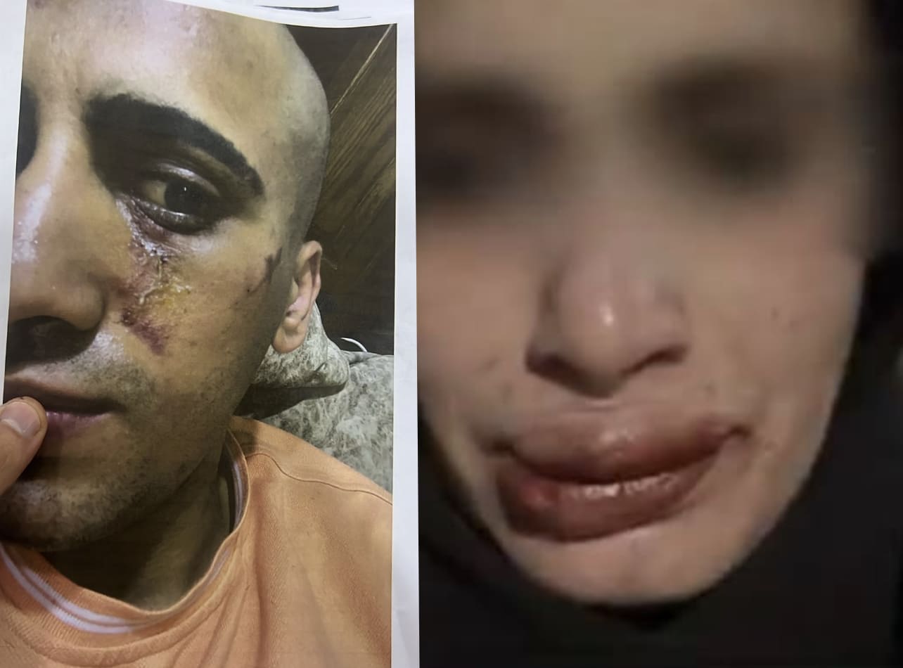 صورة حول : عاجل | أحمد يخرج عن صمته ويكشف تفاصيل تعذيبه هو وشقيقته على يد والده وإخوته .. فيديو وصور عاجل | أحمد يخرج عن صمته ويكشف تفاصيل تعذيبه هو وشقيقته على يد والده وإخوته .. فيديو وصور