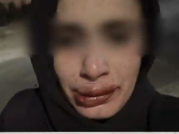 صورة حول : عاجل | أحمد يخرج عن صمته ويكشف تفاصيل تعذيبه هو وشقيقته على يد والده وإخوته .. فيديو وصور عاجل | أحمد يخرج عن صمته ويكشف تفاصيل تعذيبه هو وشقيقته على يد والده وإخوته .. فيديو وصور