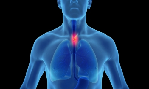 صورة حول : كبسولة مبتكرة توفر فحصًا غير جراحي للكشف المبكر عن سرطان المريء كبسولة مبتكرة توفر فحصًا غير جراحي للكشف المبكر عن سرطان المريء