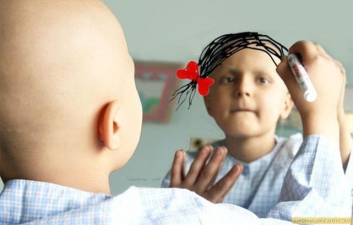 صورة حول : تعرف على أخطر 10 أنواع سرطان حول العالم وتأثيرها على المرضى تعرف على أخطر 10 أنواع سرطان حول العالم وتأثيرها على المرضى