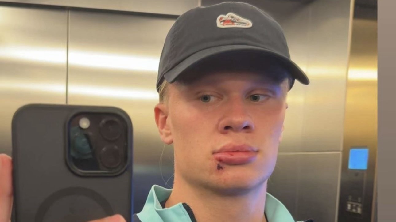 صورة حول : إيرلينغ هالاند يتعرض لإصابة طفيفة قبل مواجهة مولدوفا في تصفيات المونديال إيرلينغ هالاند يتعرض لإصابة طفيفة قبل مواجهة مولدوفا في تصفيات المونديال