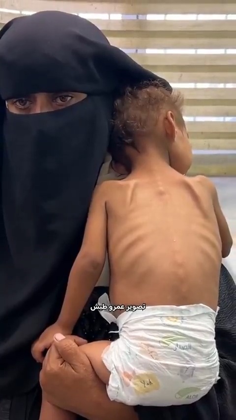 الطفلة ماسة بربخ تعاني في القطاع"فيديو"