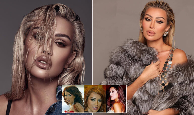 صورة حول : مايا دياب تتعرض لإصابة بسبب قنفذ بحر مايا دياب تتعرض لإصابة بسبب قنفذ بحر