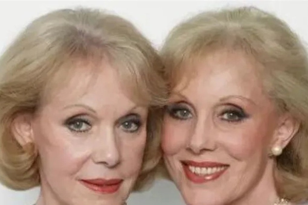 صورة حول : انتحار اشهر التوأمتين في أوروبا بقرار "موت مُساعد" انتحار اشهر التوأمتين في أوروبا بقرار "موت مُساعد"