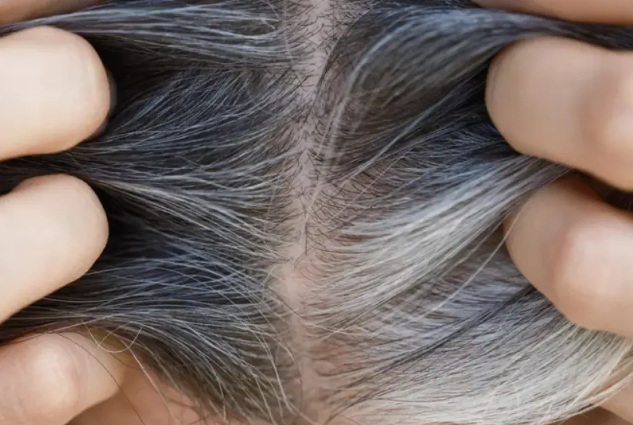 صورة حول : هل الشيب الرمادي يحميك من السرطان؟ هل الشيب الرمادي يحميك من السرطان؟