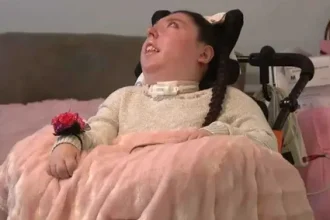 طفلة وُلدت بلا دماغ تحتفل بمعجزة عيد ميلادها العشرين