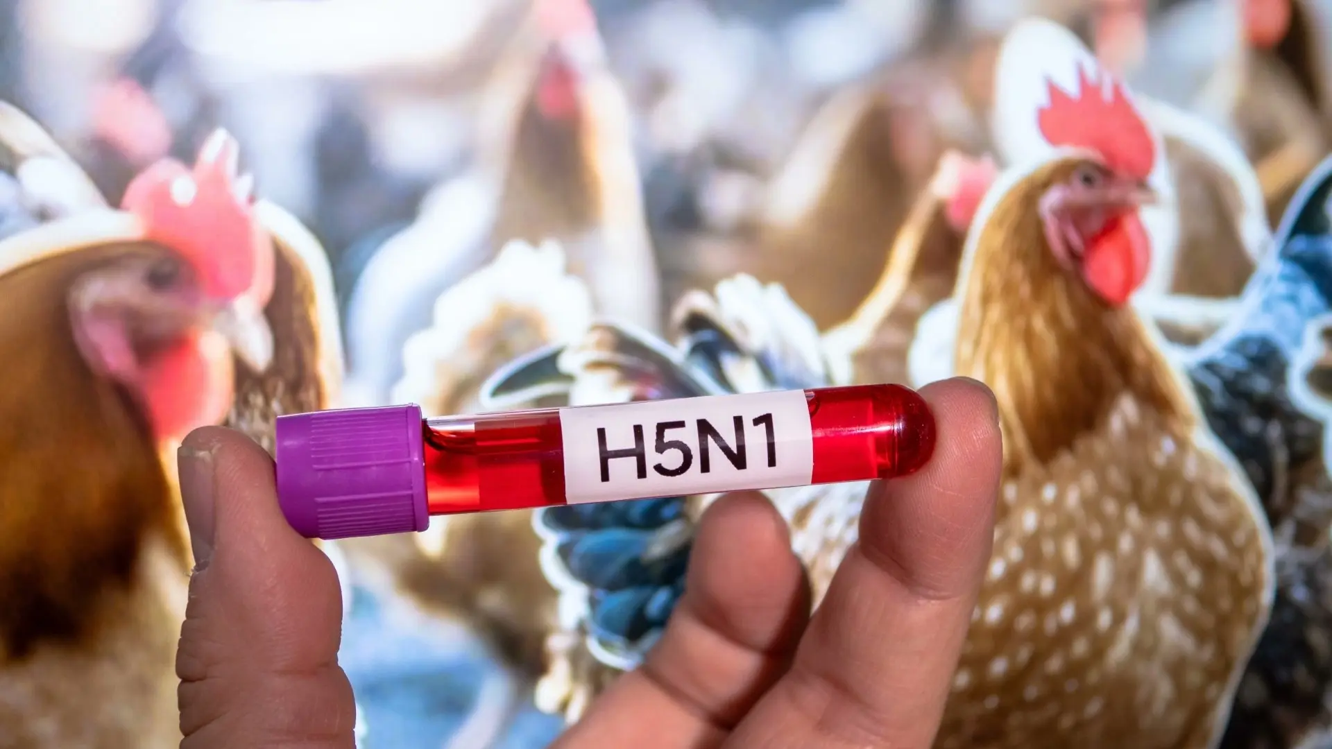 واشنطن تسجل أول إصابة بشرية بسلالة جديدة من إنفلونزا الطيور 