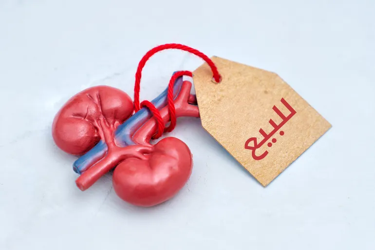 صورة حول : ضبط رجل باع جزء من كبده بالتنسيق مع شبكة لبيع الأعضاء ضبط رجل باع جزء من كبده بالتنسيق مع شبكة لبيع الأعضاء