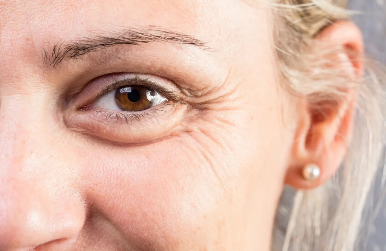 صورة حول : ملامح الوجه تكشف أسرار صحة الدماغ: التجاعيد قد تنبئ بالخرف وألزهايمر ملامح الوجه تكشف أسرار صحة الدماغ: التجاعيد قد تنبئ بالخرف وألزهايمر