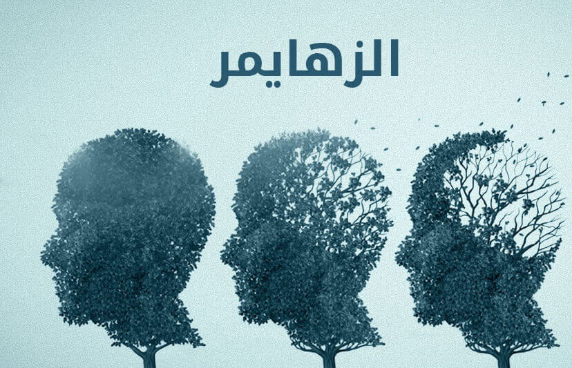 دراسة علمية تكشف عن دواء تجريبي يوقف الزهايمر قبل ظهور الأعراض