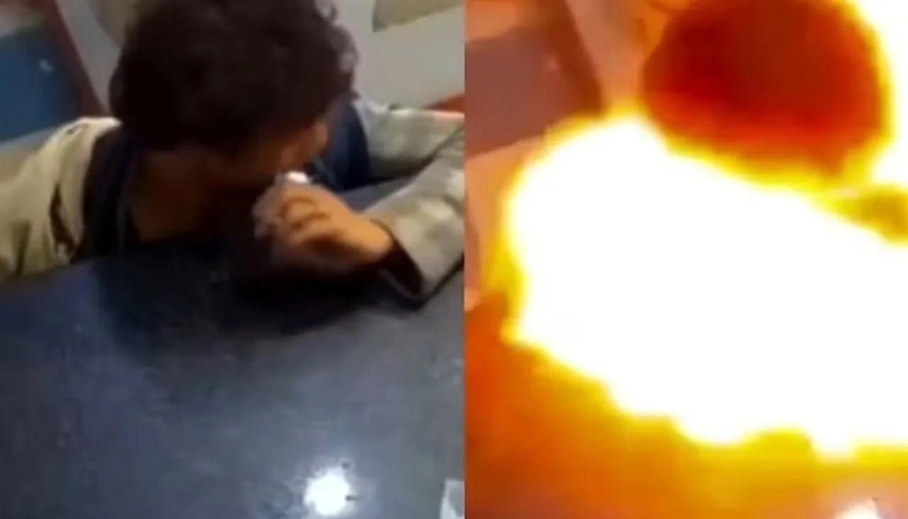 انفجار بطارية هاتف داخل فم طفل بعد أن قضمها