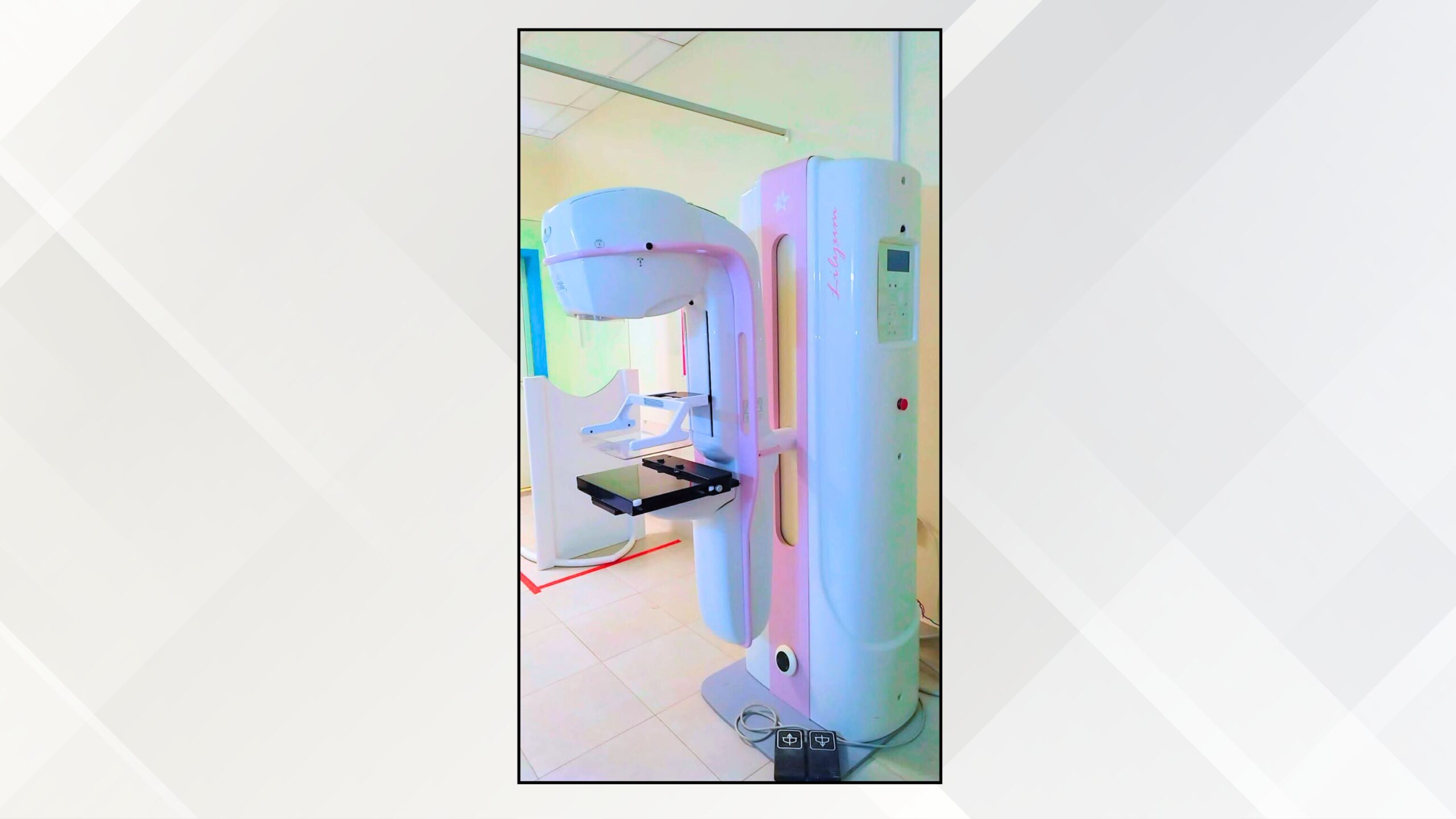 مستشفى البادية الشمالية يعيد تشغيل جهاز الماموغرام ويستأنف خدمات تصوير الثدي