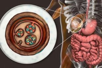داء الأكياس المائية يهدد الأطفال في الجزائر: دراسة تكشف أخطر المناطق والآثار الصحية