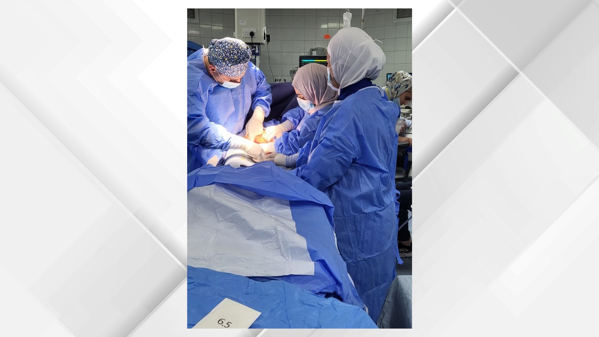 الخدمات الطبية تنجح بفصل مشيمة أحادية بالليزر