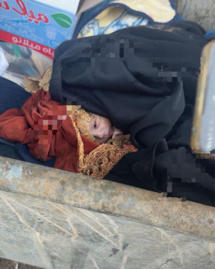 صدمة في محافظة الكرك.. العثور على رضيع داخل حاوية نفايات (صورة)