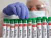 نيو ساوث ويلز تؤكد أول إصابة بإنفلونزا الطيور H5N1 وتكثف إجراءات المراقبة