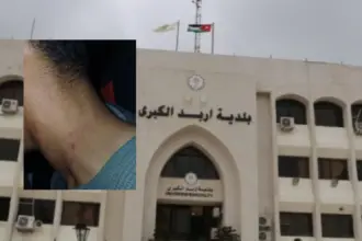 اعتداء على عامل وطن أثناء أداء واجبه في إربد والبلدية تتوعد بإجراءات قانونية