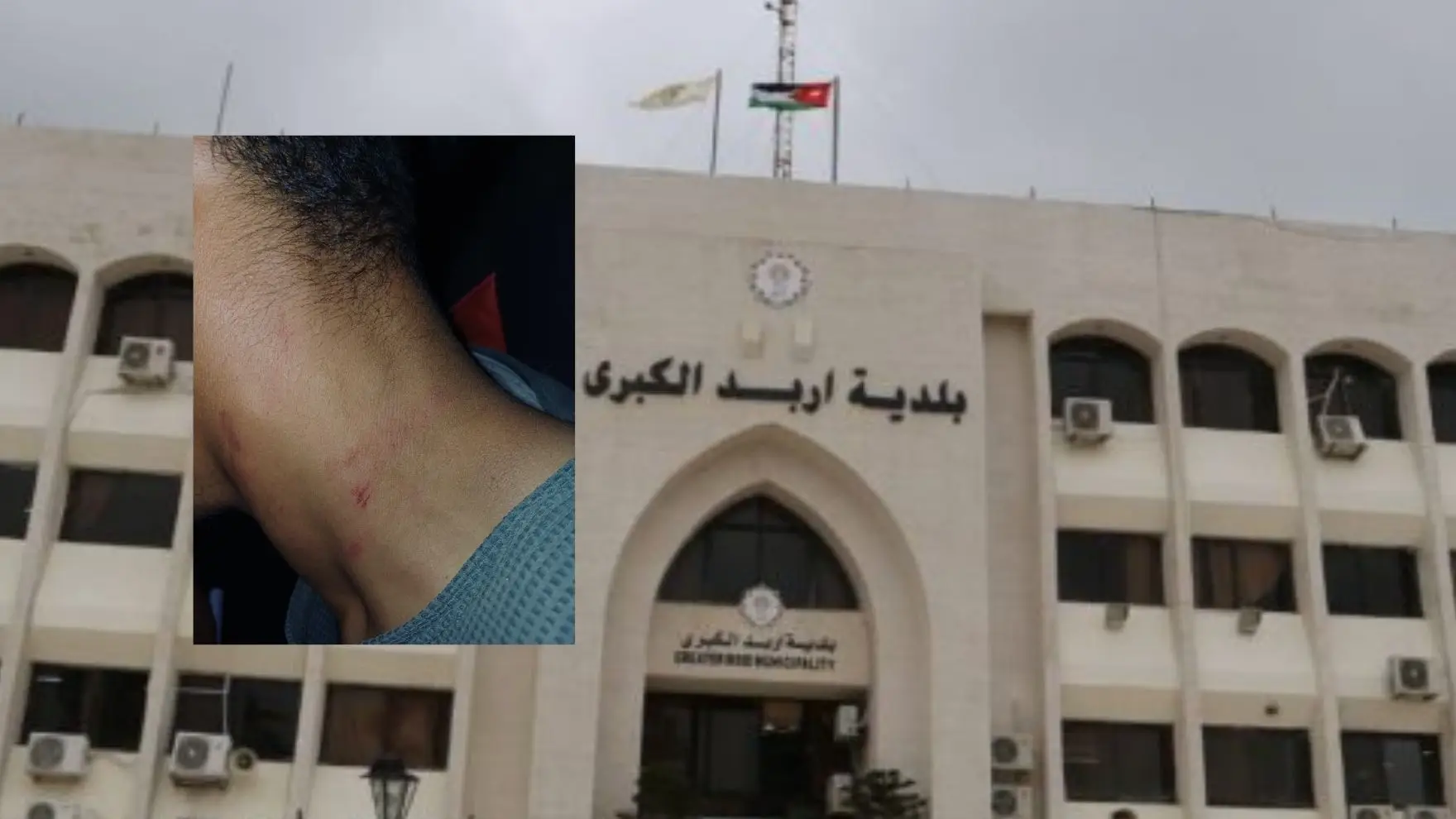 صورة حول : اعتداء على عامل وطن أثناء أداء واجبه في إربد والبلدية تتوعد بإجراءات قانونية اعتداء على عامل وطن أثناء أداء واجبه في إربد والبلدية تتوعد بإجراءات قانونية