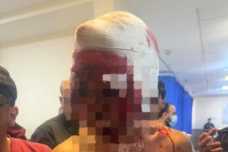 فتى ذهب للاعتذار عن شقيقه الأصغر.. فانهال عليه نحو 15 شخصا بالساطور والماسورة داخل منزل في ضاحية الحاج حسن - (صور)