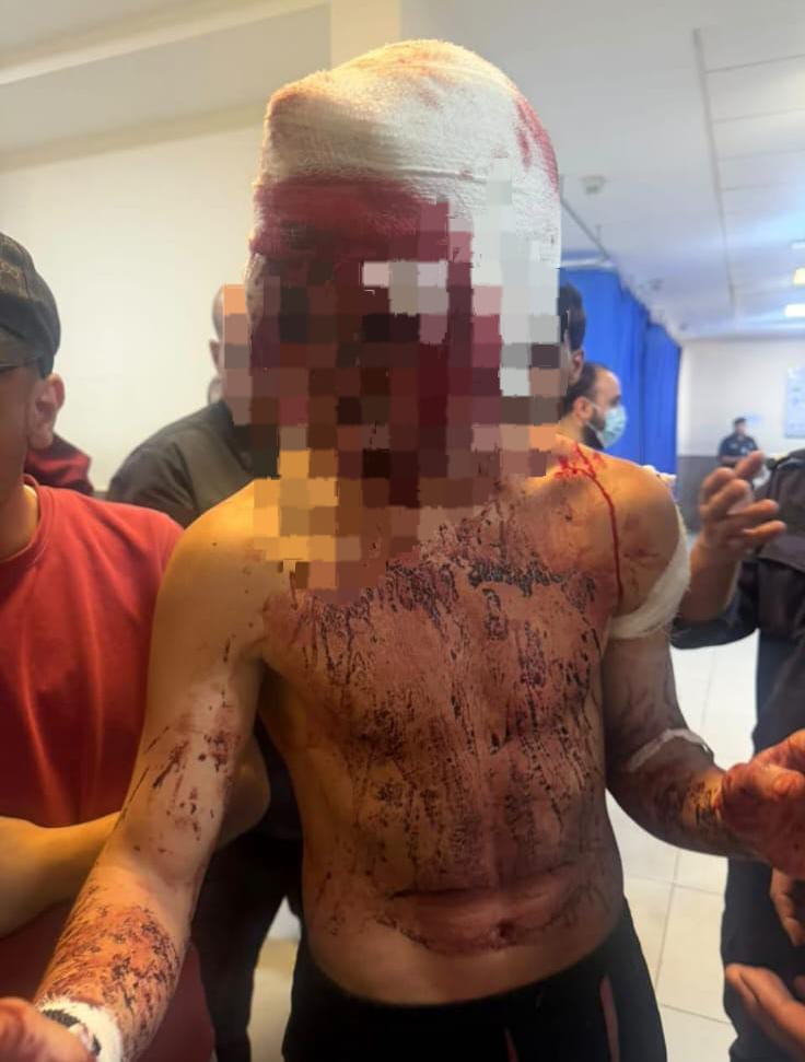 فتى ذهب للاعتذار عن شقيقه الأصغر.. فانهال عليه نحو 15 شخصا بالساطور والماسورة داخل منزل في ضاحية الحاج حسن - (صور)